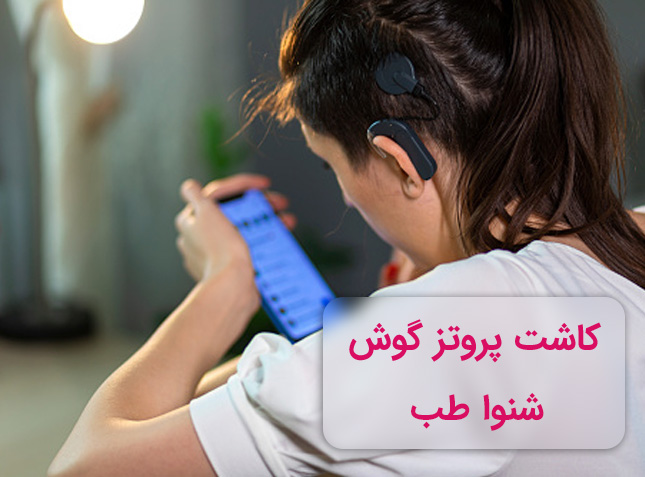 58411 جراحی کاشت حلزون چیست ؟ حلزون یا پروتز گوش و مزایای آن کاشت حلزون گوش در تهران