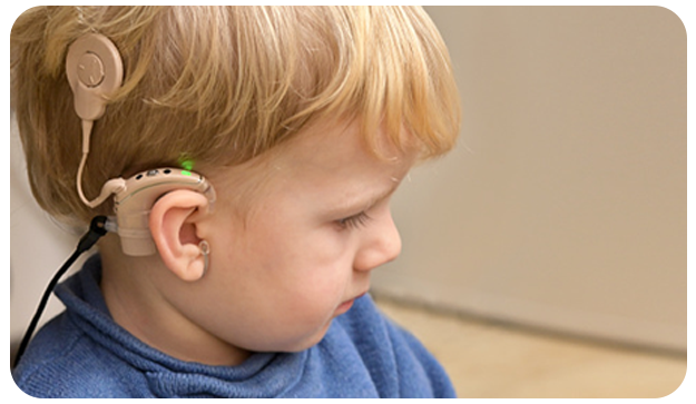 65486 جراحی کاشت حلزون چیست ؟ حلزون یا پروتز گوش و مزایای آن کاشت حلزون گوش در تهران