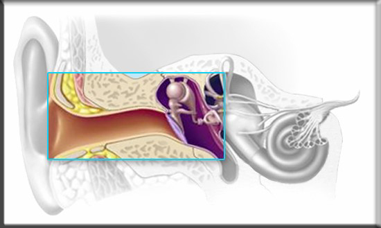 کم شنوایی حسی عصبی