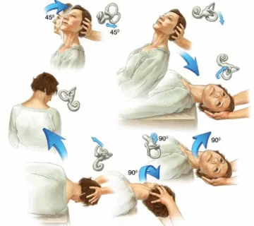 علائم جابجایی مایع گوش میانی