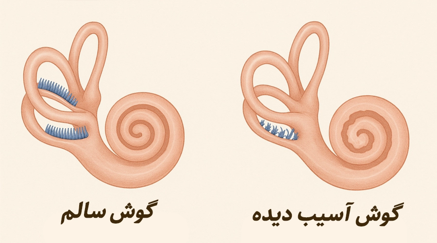 گوش آسیب دیده و گوش سالم آیا دارو میتواند باعث کم شنوایی شود؟ بررسی علمی و نکات مهم گوش سالم در مقابل گوش آسیبدیده از دارو