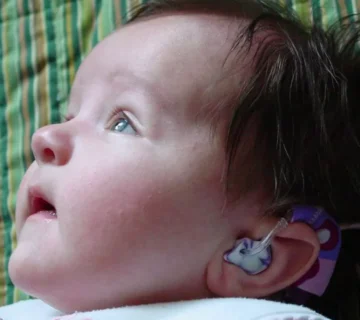 کم شنوایی مادرزادی