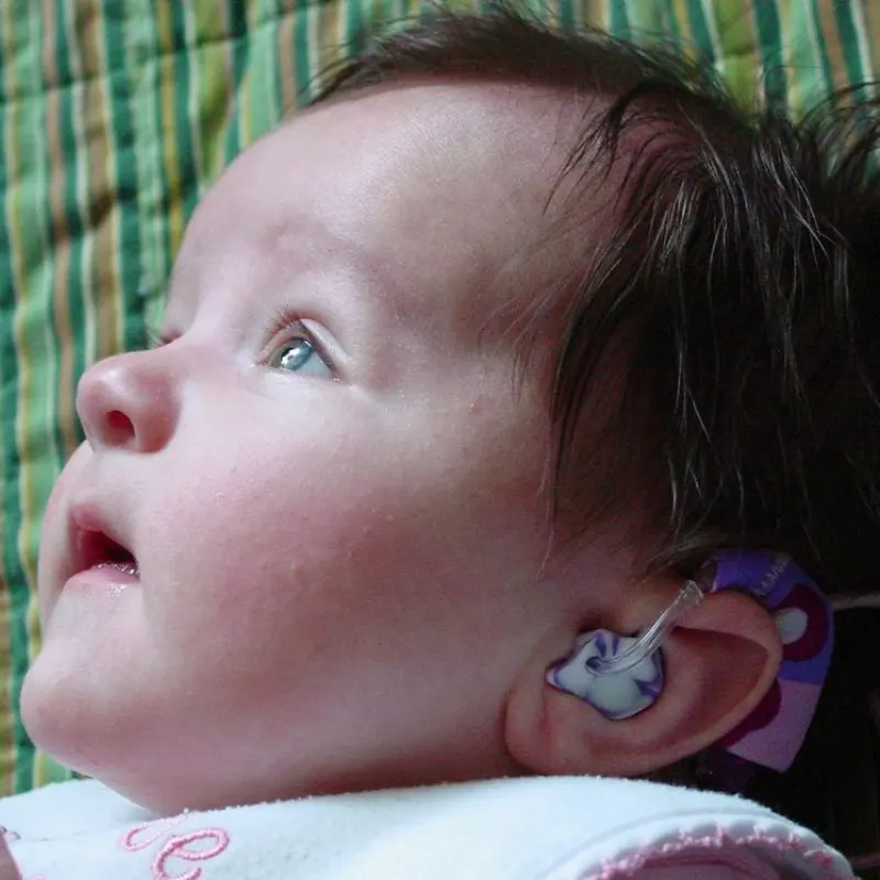 کم شنوایی مادرزادی