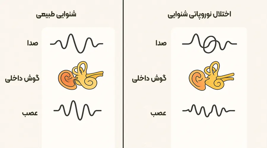 کم شنوایی عصبی درمان کم شنوایی عصبی در سال ۲۰۲۵: روشهای نوین و امیدهای تازه برای بازسازی شنوایی نمایش تفاوت شنوایی طبیعی و کمشنوایی عصبی